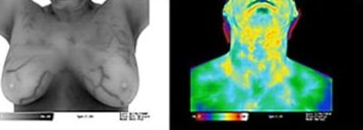 What’s so good about Thermography?