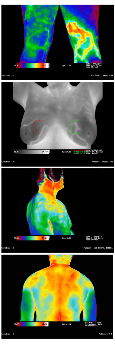 Medical Infrared Imaging Equipment